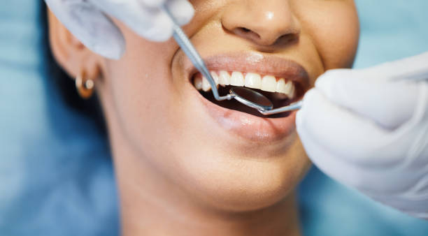 Best Emergency Root Canal Treatment in Covington, WA